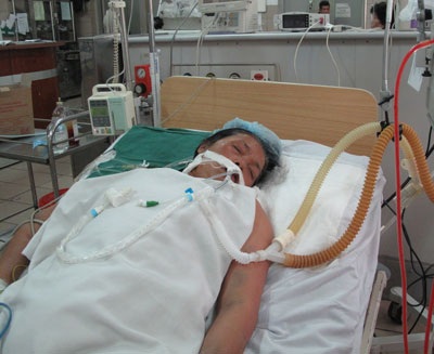 Hôn mê vì chữa viêm đại tràng mãn tính bằng rễ cây - 1 Hôn mê vì chữa viêm đại tràng mãn tính bằng rễ cây - 1