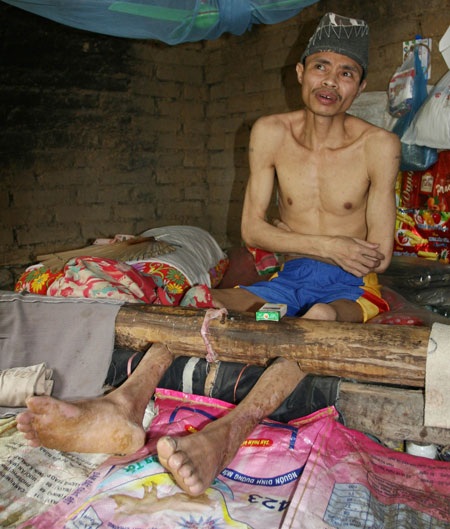 “Ngôi nhà điên” và những chuyện rùng rợn thê thảm - 1