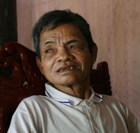 “Ngôi nhà điên” và những chuyện rùng rợn thê thảm - 3