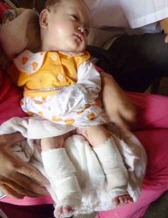 Quà nhân ái tiếp tục đến với bé Lê Uyên Nhi - 1