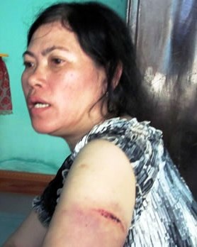 Chém người vì không được mời đi ăn đám cưới - 1