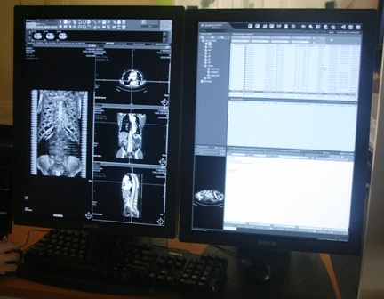 Cận cảnh những thiết bị y tế điện quang - hạt nhân tiên tiến nhất - 4