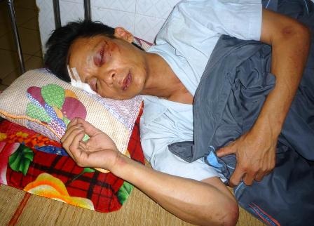 Hai chú cháu nhập viện sau khi vào trụ sở công an xã - 3