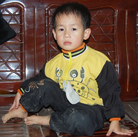 Bé hơn 3 tuổi may mắn thoát chết sau khi ngã xuống giếng sâu 9m - 1