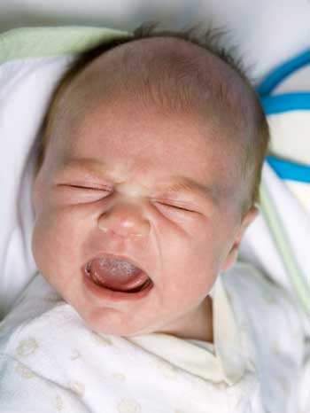 Lưu ý khi trẻ sơ sinh không khóc mà chảy nước mắt - 1 Lưu ý khi trẻ sơ sinh không khóc mà chảy nước mắt - 1