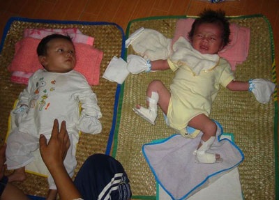 Bé Nhân Đức đã được xuất viện - 4 Bé Nhân Đức đã được xuất viện - 4