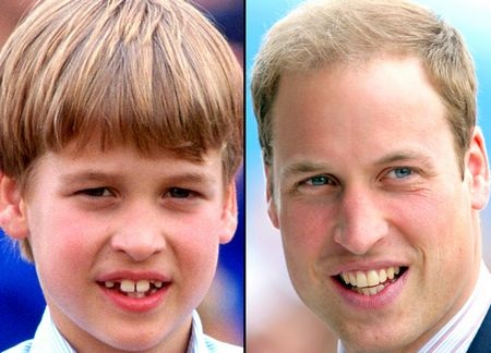 Các nhân vật hoàng gia thế giới: Ngày ấy - Bây giờ - 6