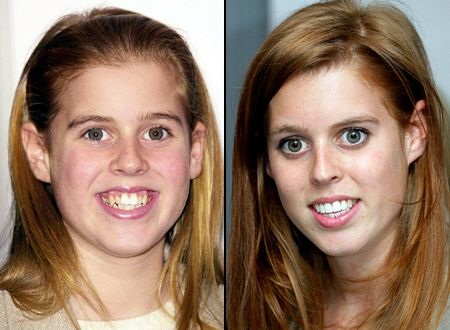 Các nhân vật hoàng gia thế giới: Ngày ấy - Bây giờ - 9