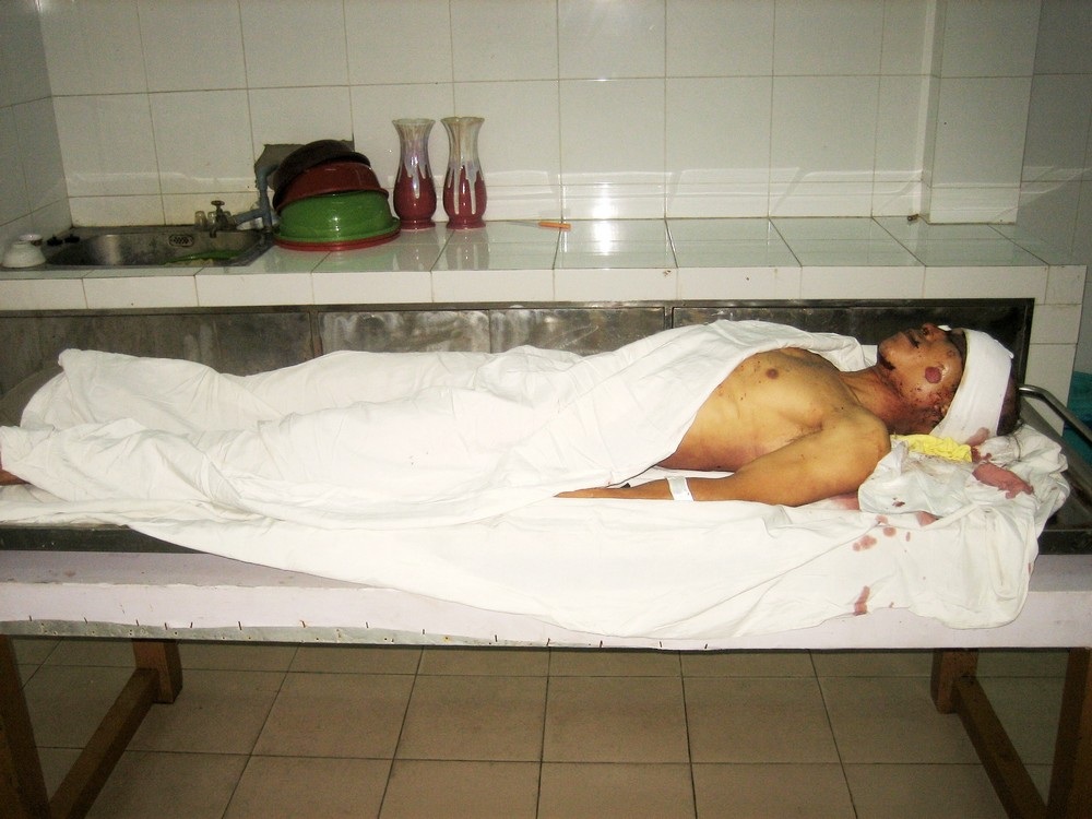 Trộm chó bị truy đuổi, ngã xe máy tử vong - 1 Trộm chó bị truy đuổi, ngã xe máy tử vong - 1