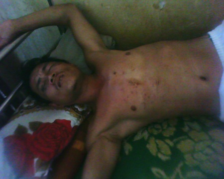 Một thanh niên bị “hành hình” dã man - 1