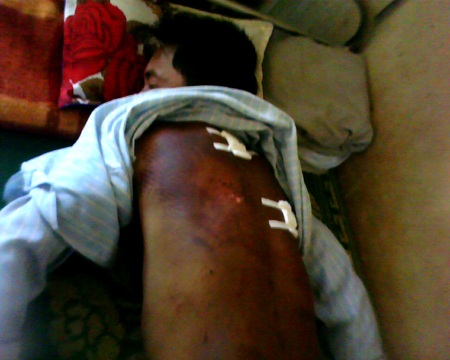 Một thanh niên bị “hành hình” dã man - 2