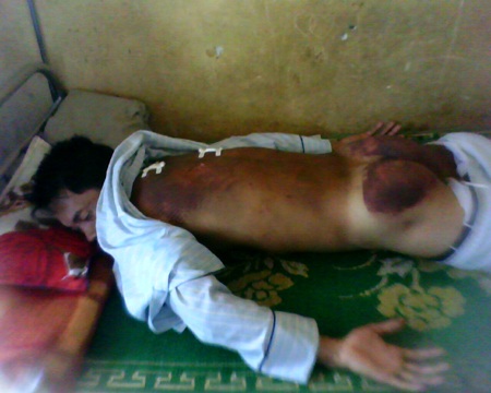 Một thanh niên bị “hành hình” dã man - 3