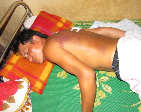 Sẽ làm nghiêm vụ một thanh niên bị “hành hình” dã man - 2