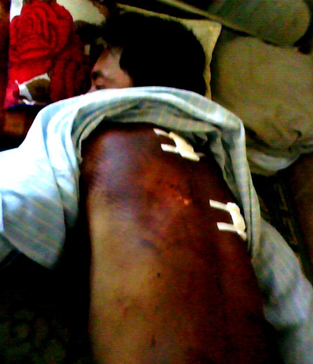 Sẽ làm nghiêm vụ một thanh niên bị “hành hình” dã man - 1