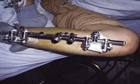 Chuốc vạ vì “giấc mơ chân dài” - 1