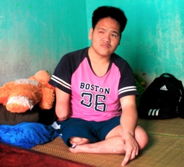 Nuôi ước mơ vào đại học bằng chân gỗ, mắt mờ - 1 Nuôi ước mơ vào đại học bằng chân gỗ, mắt mờ - 1