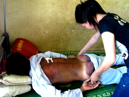 Tạm giữ 6 đối tượng trong vụ nam thanh niên bị “hành hình” - 1