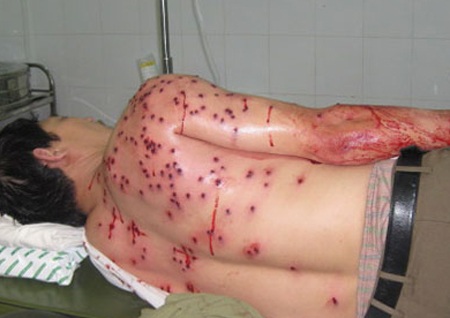 Can đánh nhau, người đàn ông lĩnh đạn hoa cải - 1