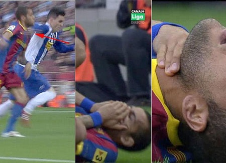 Dani Alves bị báo giới Madrid tố chơi bẩn - 1