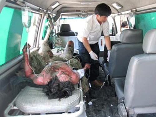 Bị phóng điện, xe chở dưa bốc cháy, 4 người nguy kịch  - 2