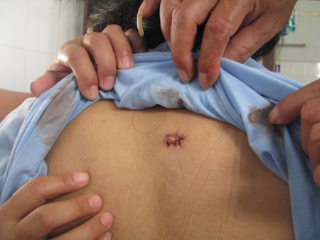 Nữ sinh dùng kéo giải quyết mâu thuẫn - 1