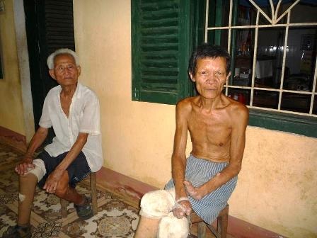 30 năm lặng thầm gắn bó với bệnh nhân phong    - 3