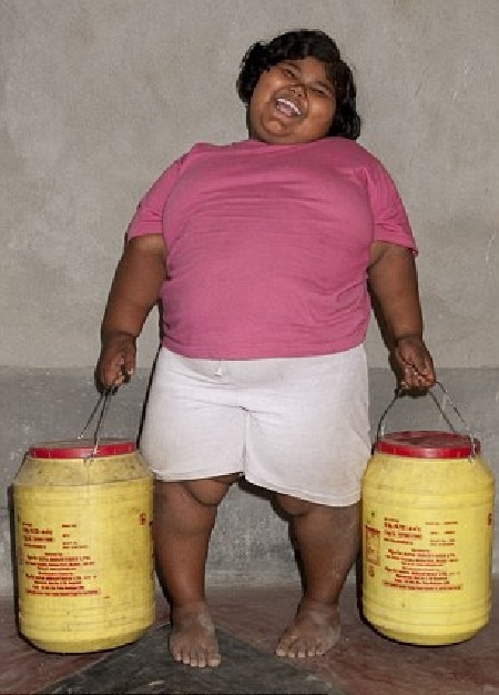 Sốc với bé gái 6 tuổi nặng 91kg - 2