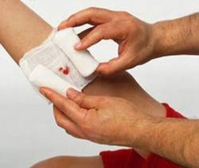 Để không bị hoại tử chi, cần garo và băng ép đúng cách - 1 Để không bị hoại tử chi, cần garo và băng ép đúng cách - 1