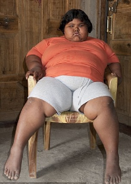 Sốc với bé gái 6 tuổi nặng 91kg - 1