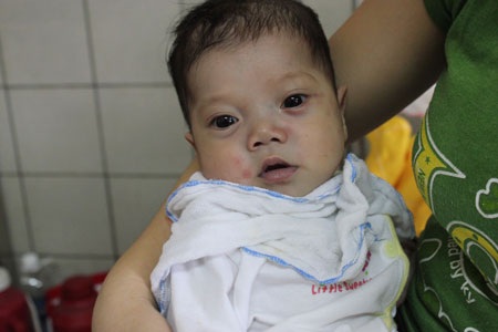 Nhịp thở khó khăn của bé 7 tháng tuổi bị bệnh tim bẩm sinh - 1