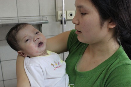 Nhịp thở khó khăn của bé 7 tháng tuổi bị bệnh tim bẩm sinh - 3