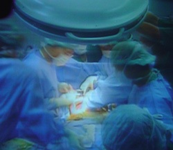 Ca ghép gan tại Viện Nhi Trung ương đã thành công mỹ mãn - 7 Ca ghép gan tại Viện Nhi Trung ương đã thành công mỹ mãn - 7