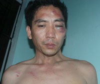 Giải cứu an toàn con tin bị một tên cướp vây hãm - 1