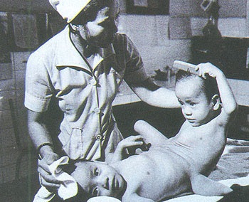 Cặp song sinh Việt - Đức ngày ấy... bây giờ - 1 Cặp song sinh Việt - Đức ngày ấy... bây giờ - 1