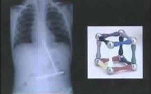 Những chiếc dạ dày “khủng” - 4