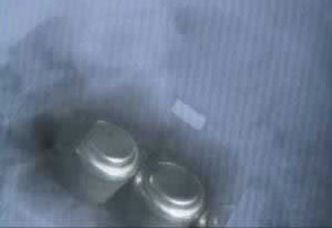 Những chiếc dạ dày “khủng” - 7