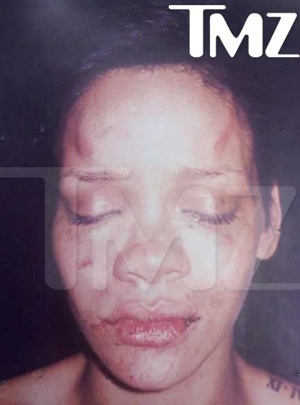 Ảnh Rihanna bị người yêu hành hung - 1 Ảnh Rihanna bị người yêu hành hung - 1