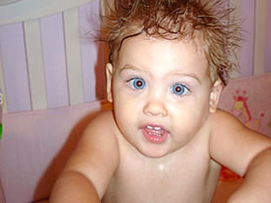 Con gái Anna Nicole Smith bị lác mắt - 2