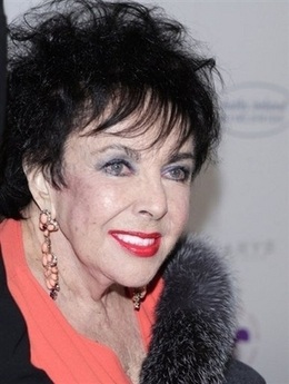 “Elizabeth Taylor vẫn khỏe” - 1
