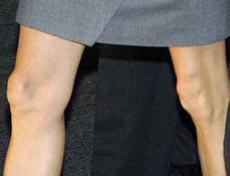 Angelina Jolie lộ đầu gối “củ lạc”! - 2