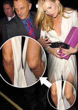 Những khoảnh khắc "khó coi" nhất của “sao” - 5 Những khoảnh khắc "khó coi" nhất của “sao” - 5