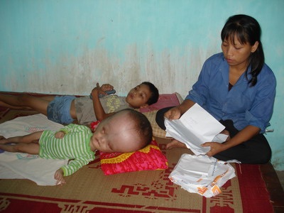 Trao tiền ủng hộ của bạn đọc tới cậu bé “ngoài hành tinh” - 1 Trao tiền ủng hộ của bạn đọc tới cậu bé “ngoài hành tinh” - 1