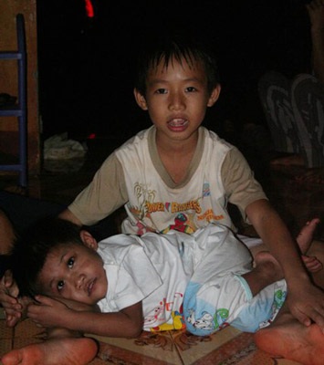 Một ngày với bé Hảo tại trại trẻ mồ côi - 4