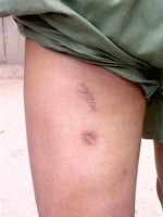 Sống trong tầm… đạn lạc - 2