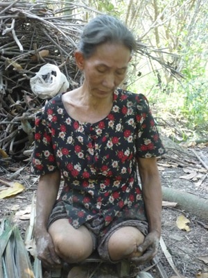 Đi bằng hai tay, nuôi chồng bệnh tật - 1 Đi bằng hai tay, nuôi chồng bệnh tật - 1