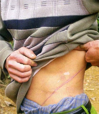 Người mang nhóm máu O - 2