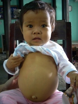 Cô giáo Trần Thị Nga Minh nhận 7.260.000 đồng tiền ủng hộ - 1