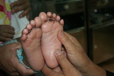 Bé gái 2 tuổi bị cắt ngón chân, đánh hộc máu - 1