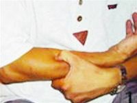 Tự chữa bệnh trĩ bằng Đông y - 2