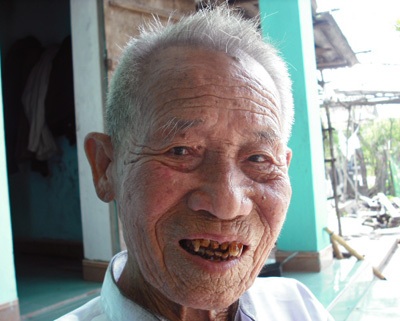 Hà Tĩnh: Cụ già gần 100 tuổi lại mọc răng - 1